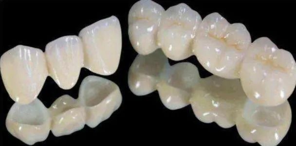 做了根管治疗戴了牙套的牙又疼,做了牙齿矫正感觉戴牙套好丑啊