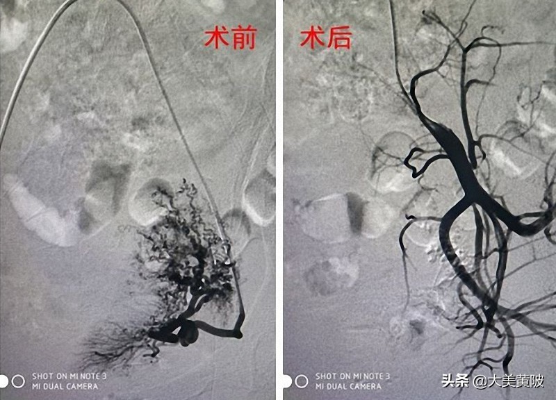 黄陂区人民医院妇产科怎么样,黄陂区人民医院看妇科怎么样