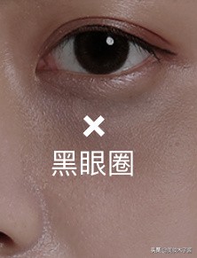 眼周提升方法,眼周提升正确手法