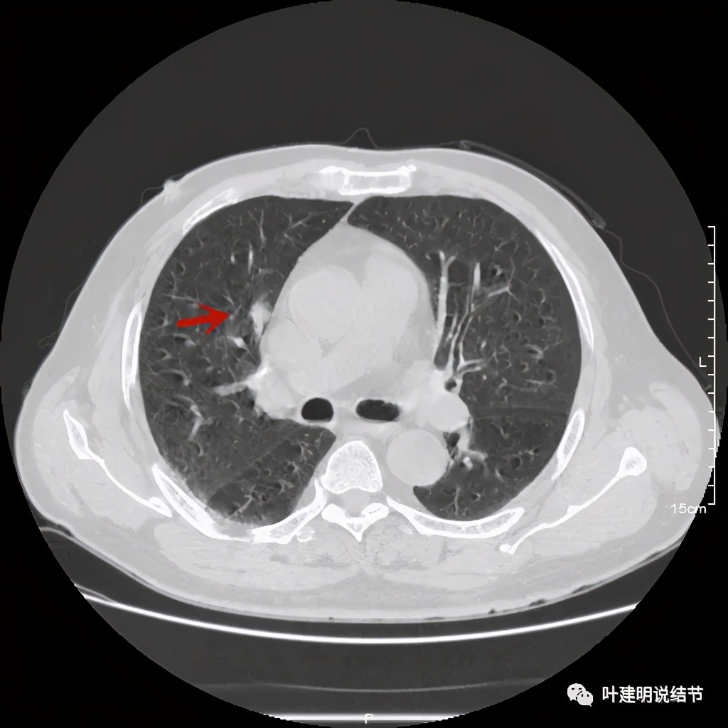 误诊报告图片,误诊案例及案例分析