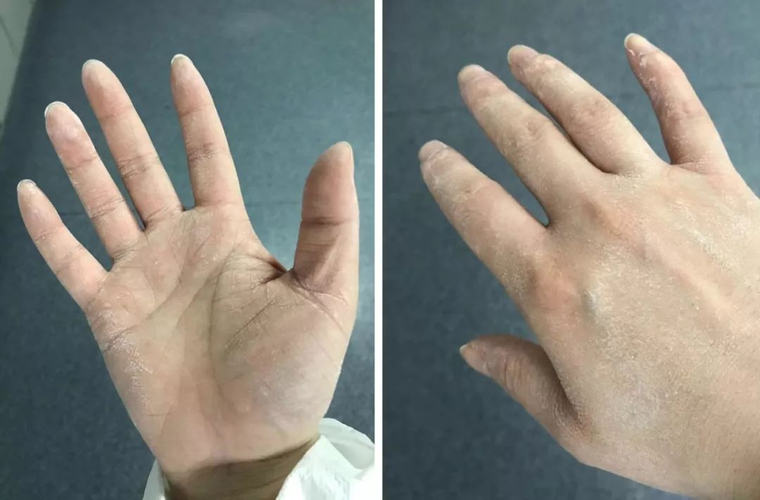 封城11日，武汉众生图