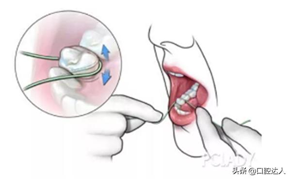 补过的牙几年后突然又疼了怎么治,补了几年的牙突然疼痛要如何解决