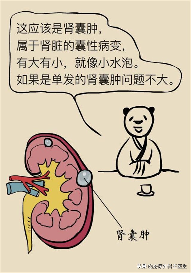 体检发现肾囊肿怎么办,体检中常见肾囊肿怎么治疗