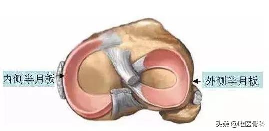 半月板科普小知识,半月板一二三度损伤报告