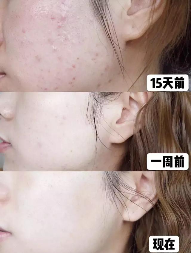 姘ㄥ熀閰稿噣閫忕編鐧芥磥闈钩鐩存挱,姘ㄥ熀閰告场娌礂闈㈠ザ缇庣櫧鐩存挱