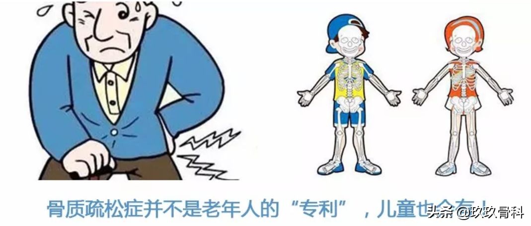 小孩会得骨质疏松症吗,儿童骨质疏松的症状有哪些