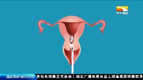 怀孕13周孩子会自然掉出来吗,孕中期觉得孩子要掉出来