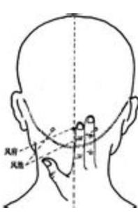 春天过敏咳嗽怎么办,春天到了身上过敏长红疙瘩怎么办