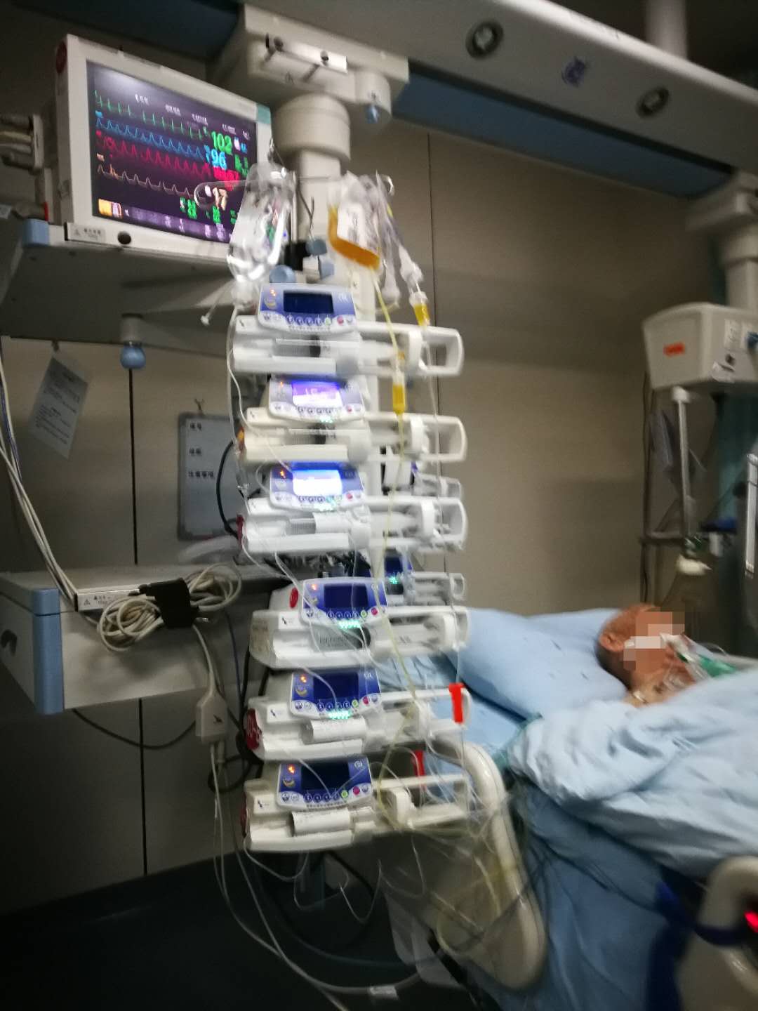 骨折引起肺栓塞好治吗,80岁老人肺栓塞怎么治