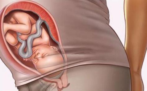 预产期临近，阵痛明显，胎儿不入盆怎么办？听听专家怎么说