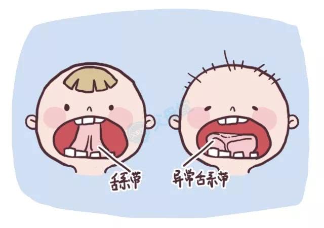 宝宝说话舌头不灵怎么办,宝宝舌系带厚短说话不清楚