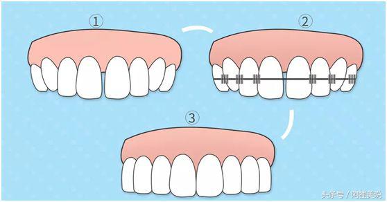 从3分到10分中间需要几分钟,从3分到4分付出了多大努力