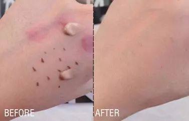 油皮平价粉底unny,粉底油皮推荐平价学生遮瑕能力好