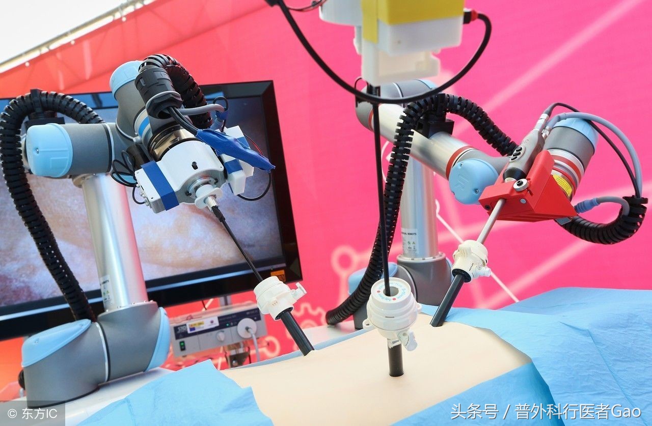 杏仁：一图一话全面解析阑尾的切除过程（干货，不懂医也学习了）