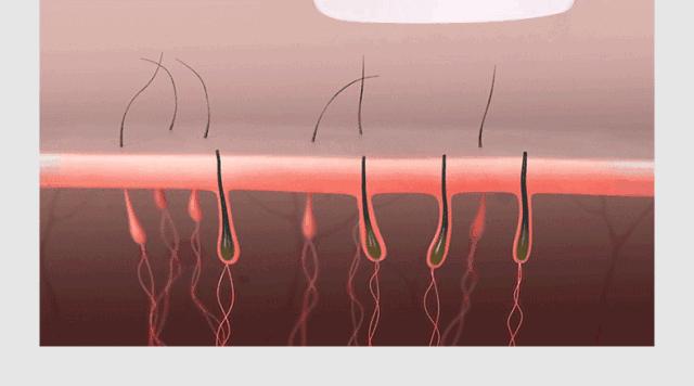 最基础最全面的医美项目是什么,有哪些比较好的医美项目