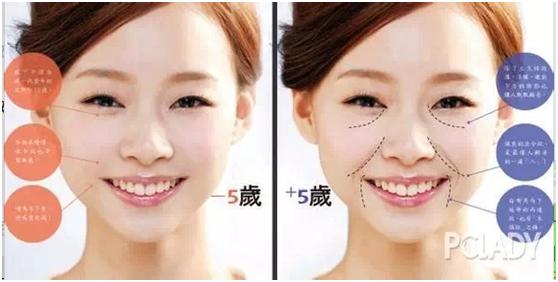 法令纹显老做什么美容最好,法令纹怎么消除最显老