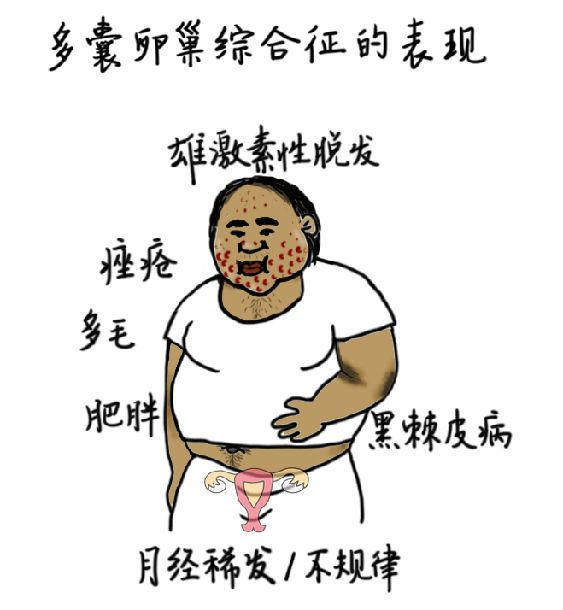 19岁左右身上长毛是怎么回事,12岁女孩身体浑身长毛是什么病