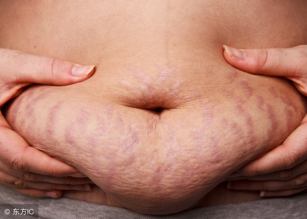 孕期身体的变化生产后都会恢复吗,怀孕后妈妈的身体发生了哪些变化