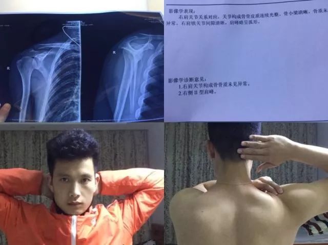 蔡赟谈林丹为什么不适合打双打,蔡赟技术讲解