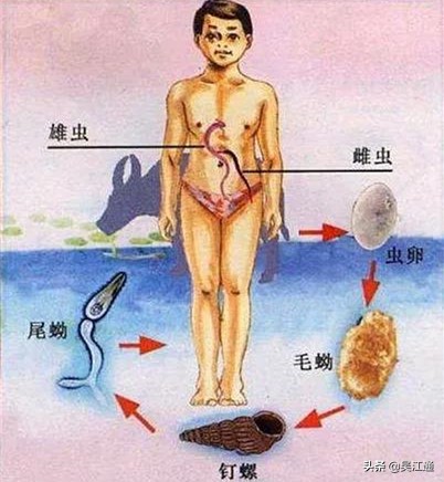 鎴戠粡鍘嗙殑鐤儏,鎴戠粡鍘嗙殑鎶楃柅鏁呬簨