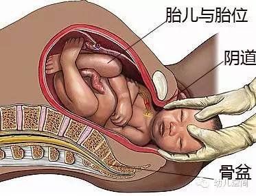 侧切的10大忌,顺产的10大忌