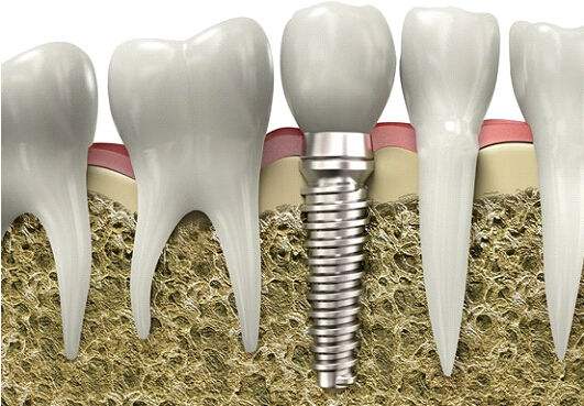 牙疼是不是拔牙就可以缓解,牙疼并且牙齿有松动要拔牙吗