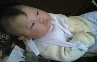 双排牙预防方法,预防孩子双排牙有什么方法