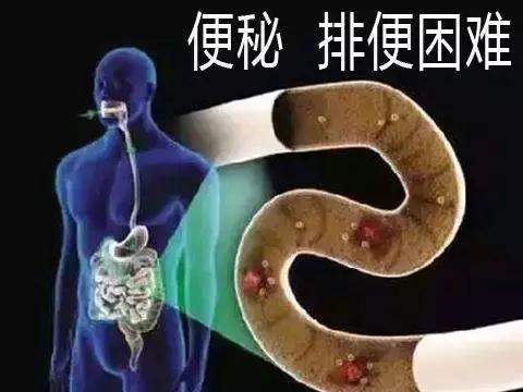 肠道有4大症状说明病得不轻,不确定身体哪里出了问题