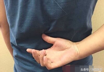 恶性黑色素瘤等于死亡?心酸和无奈,他是怎样维持了一年又一年