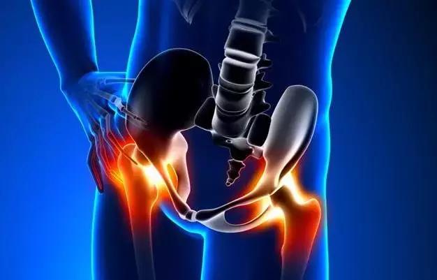 股骨头坏死病因及危险因素,股骨头容易坏死的部位