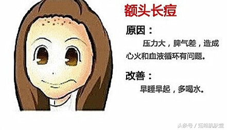 下巴长满痘痘是什么原因怎么调理,下巴不停冒脓包型痘痘怎么样调理