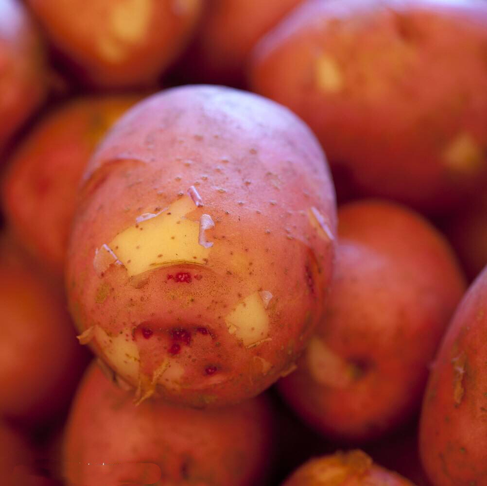 痔疮怎么不治而愈,痔疮有什么方法不让它发作