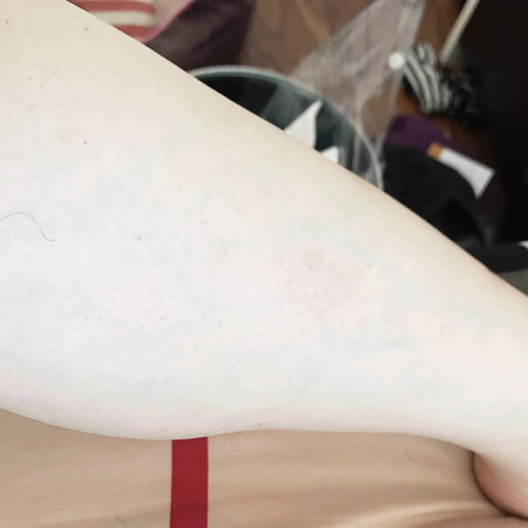 最好用最不伤皮肤的脱毛膏,最好用的脱毛膏推荐还便宜