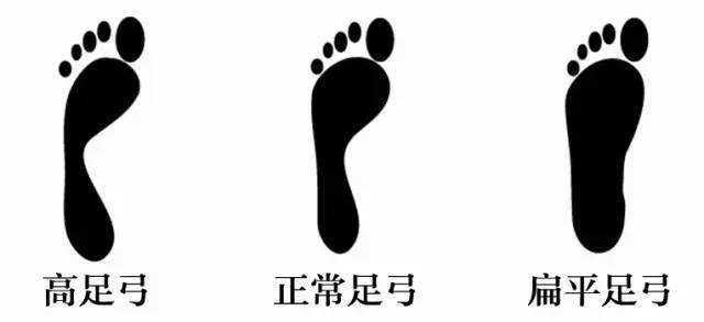 正常足弓买稳定性还是缓震型跑鞋,高足弓跑鞋选择缓震还是支撑