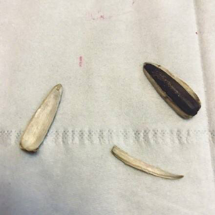 女生一不小心口红摔断了要怎么弄,女生口红弄断了怎么办