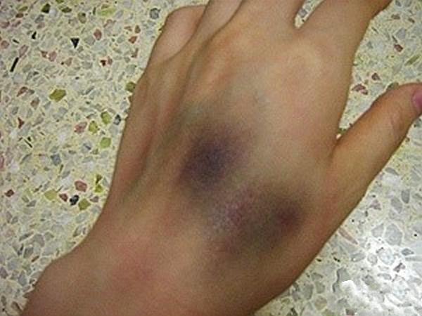 装病请假必备技巧