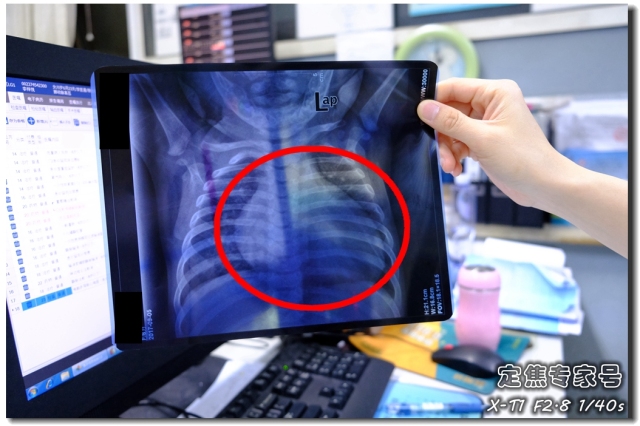 会得大病的手相掌纹,不懂中医怎么看手相