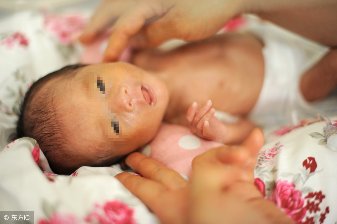 预防早产儿妈妈需注意4件事,导致早产儿的原因是什么