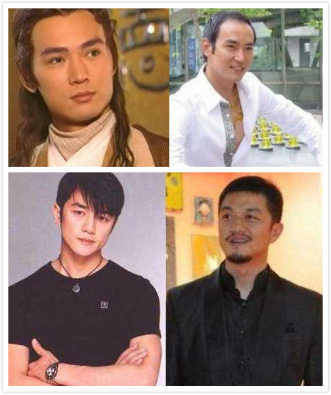 头发太少影响颜值了怎么办,细软头发如何防脱发