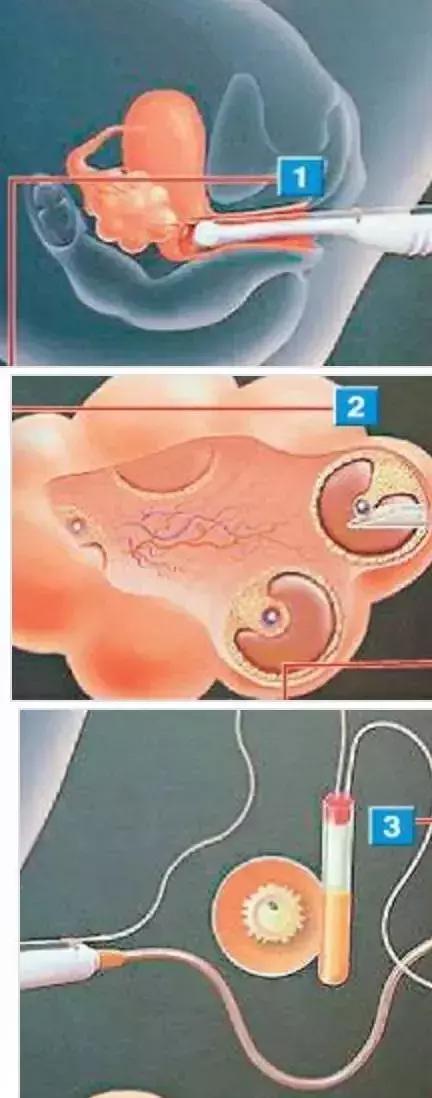 鎹愬嵉灏忓箍鍛婃鑳介噺,楂樻牎鎹愬嵉骞垮憡瑙嗛