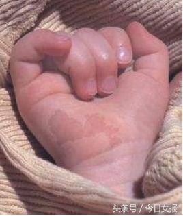 吃了活蝌蚪会怎样,喂孩子吃活蝌蚪能治病