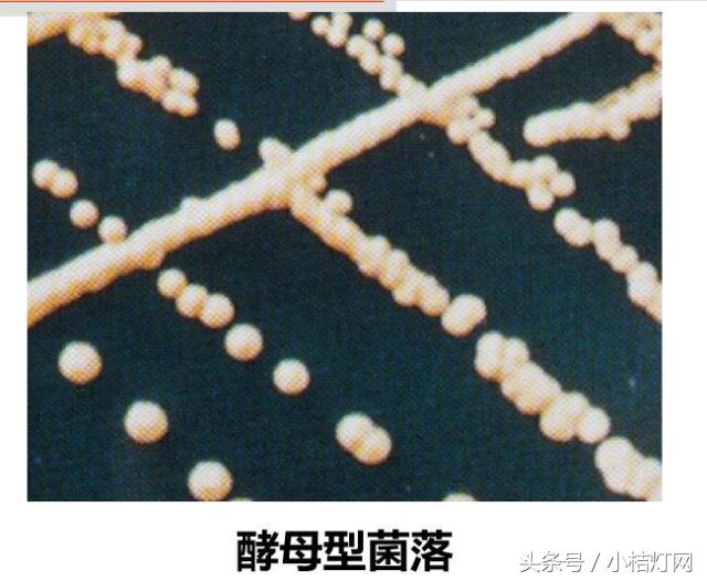 ivd基础知识大全,真菌检测要点