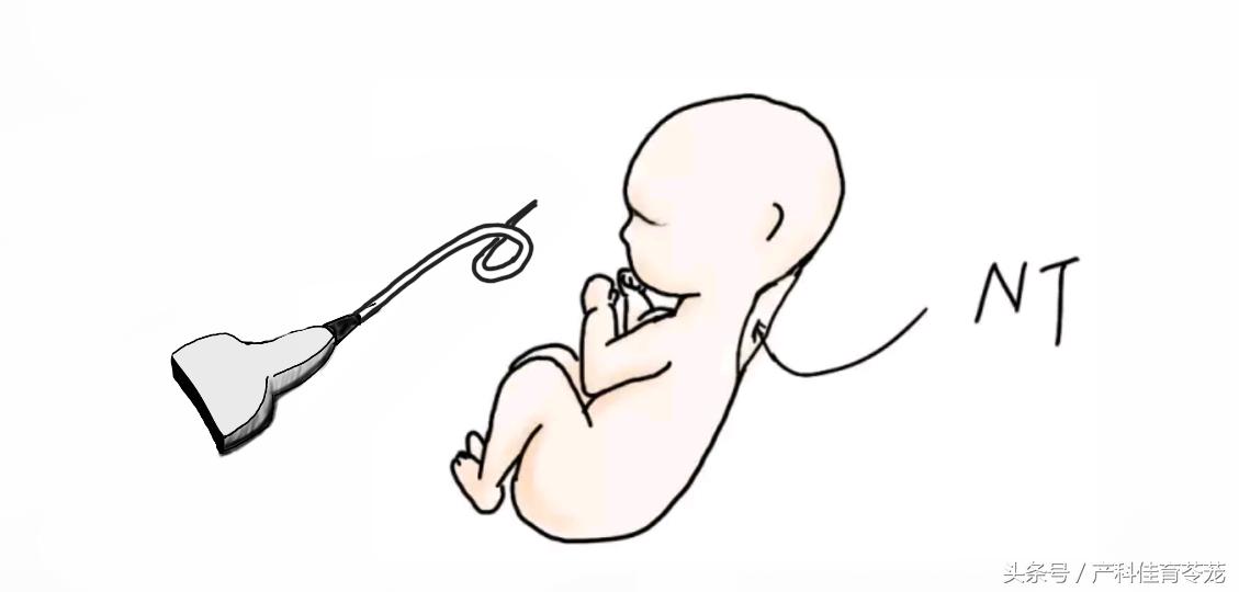 孕期肥胖的原因及解决方法,孕期看看自己胖成什么样了