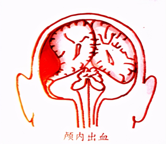 宝宝摔到头怎么应对,宝宝摔到头怎么处理最好