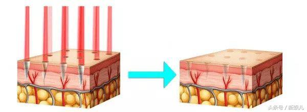 为什么范冰冰比林允气质好,范冰冰王菲谁漂亮