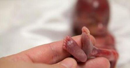 孩子被打掉是什么过程,孩子是怎样被打掉的