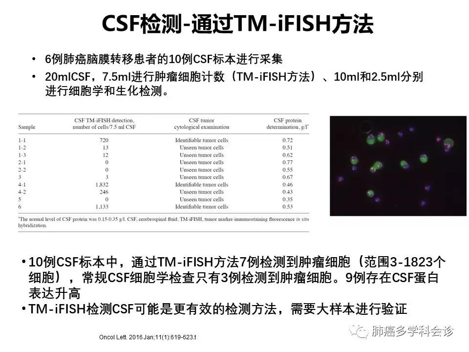 【宣晟医疗】肺癌脑膜转移的诊断方法及研究进展