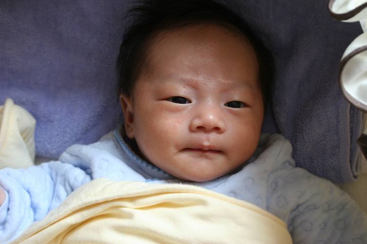 什么是奶癣小儿奶癣该怎么办,婴儿的奶癣是怎样的