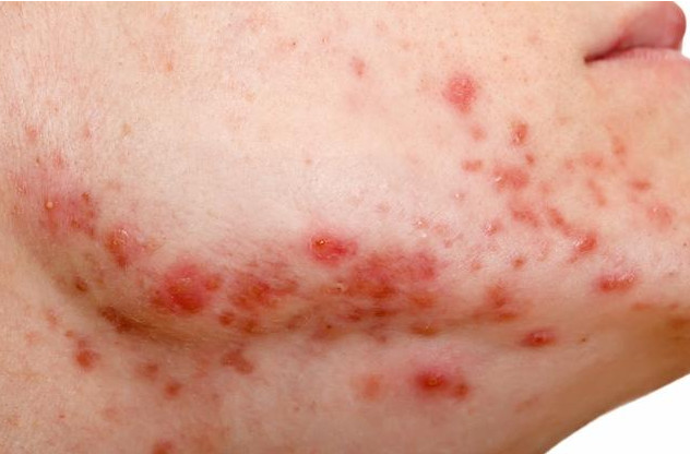 尿液发黄起泡沫可能与肝脏有关系,半夜起来尿液发黄是怎么回事