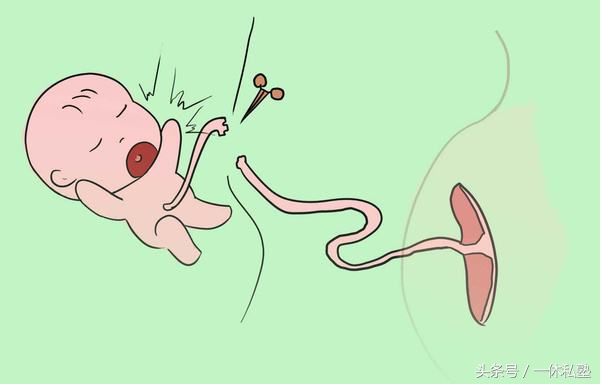 宝宝脐带护理不当会引起新生儿败血症，家长要重视